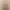 Abdominoplasty