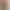 Penis enlargement